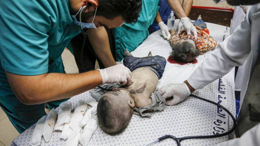 Gazze'de 'insanlık' ölüyor... Hastane mezarlığa döndü 8